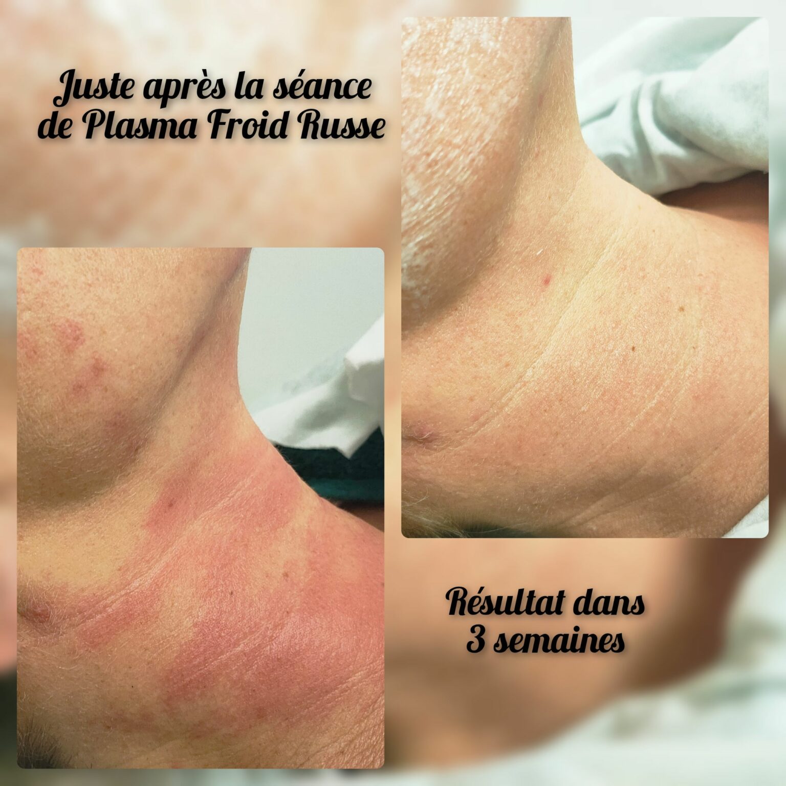 plasma nataha beauté 7